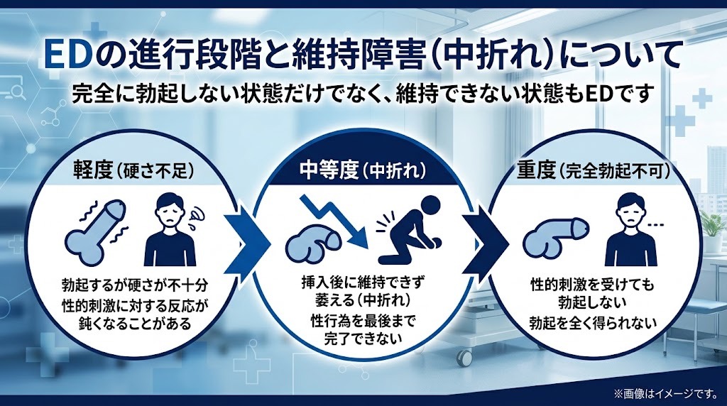 EDの定義と段階別症状（軽度・中等度・重度）を示す図解イラスト