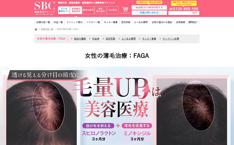 湘南AGAクリニックの女性の薄毛治療(FAGA)
