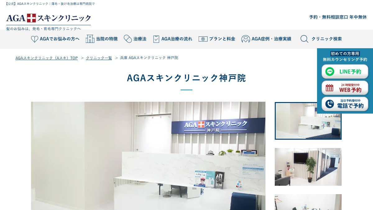 AGAスキンクリニック 神戸院の公式サイト
